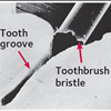 Teeth Cleaning Exams Xrays 843-797-0782 Huch Family Dentistry Root Canals Goose Creek Dental Service