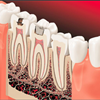 Xrays Dental Services Goose Creek 843-797-0782 Huch Family Dentistry Exams Root Canals